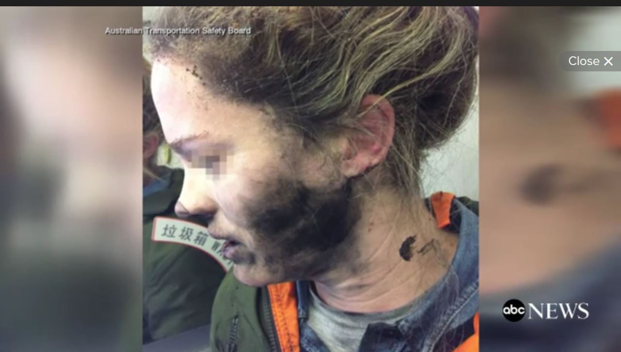 Mujer sufre quemaduras al explotarle sus audífonos en pleno vuelo